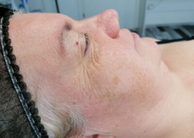 Trattamento viso professionale eseguito da Giorgia Arzenton presso Aurea Studio
